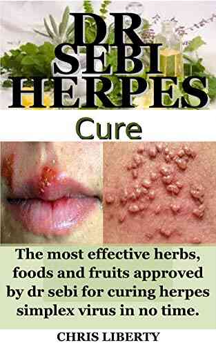 DR SEBI HERPES CURE : The most effective herbs foods and fruits approved by dr sebi for curing herpes simplex virus in no time