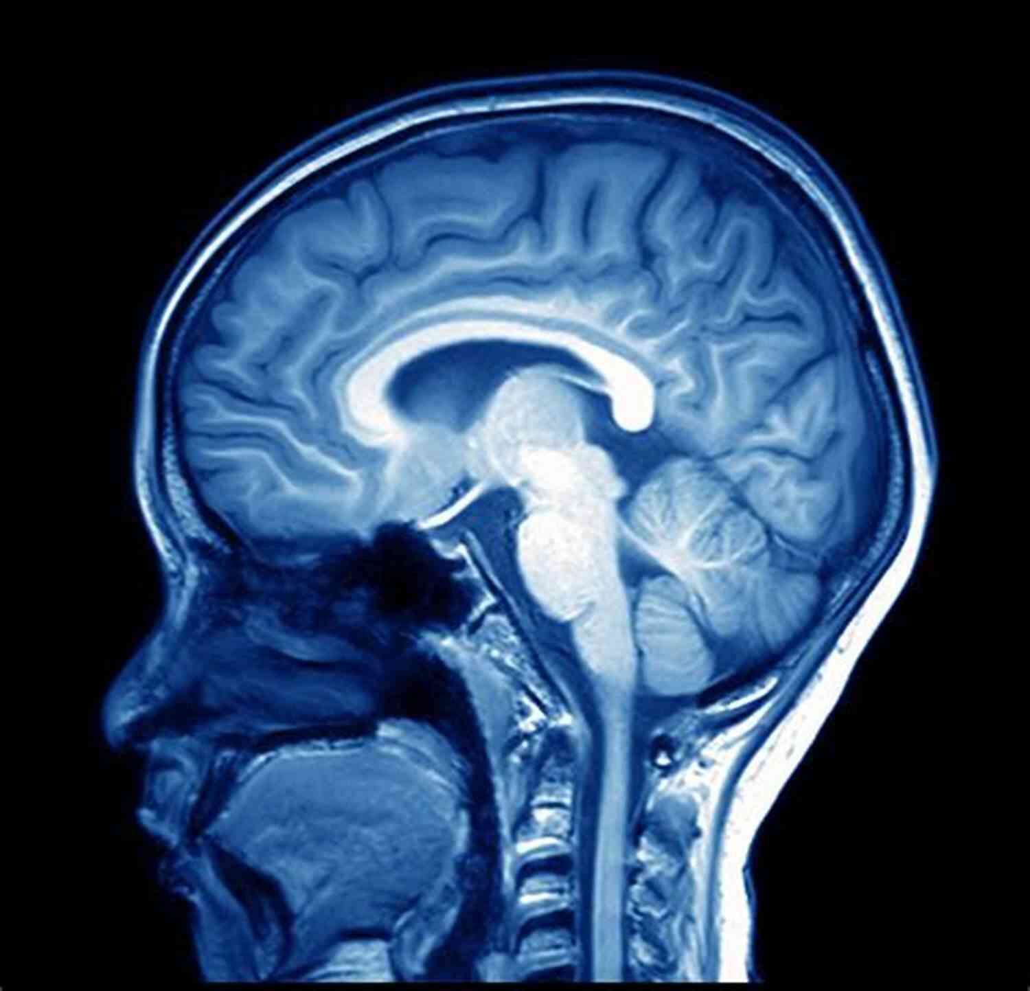 MRI Scan Of A Brain Desperate Remedies: Psychiatry S Turbulent Quest To Cure Mental Illness